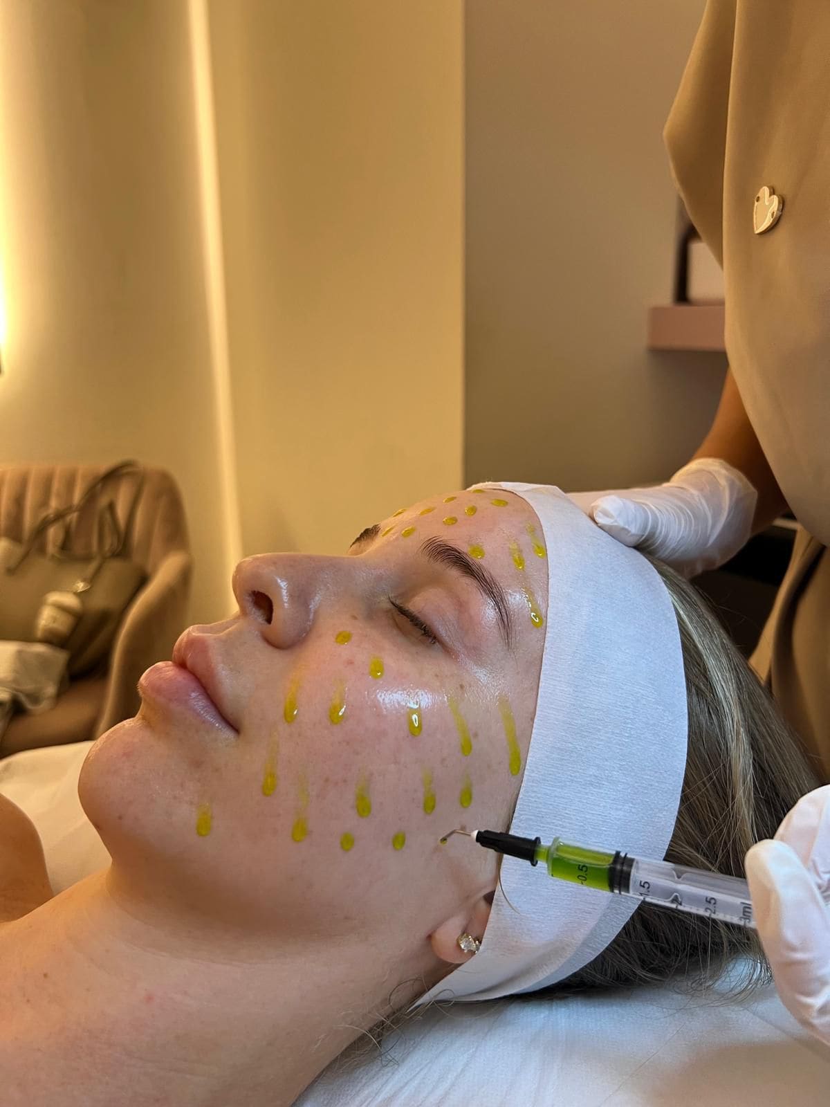BIOREPEEL CL3 — tratamiento en Bloom Beauty