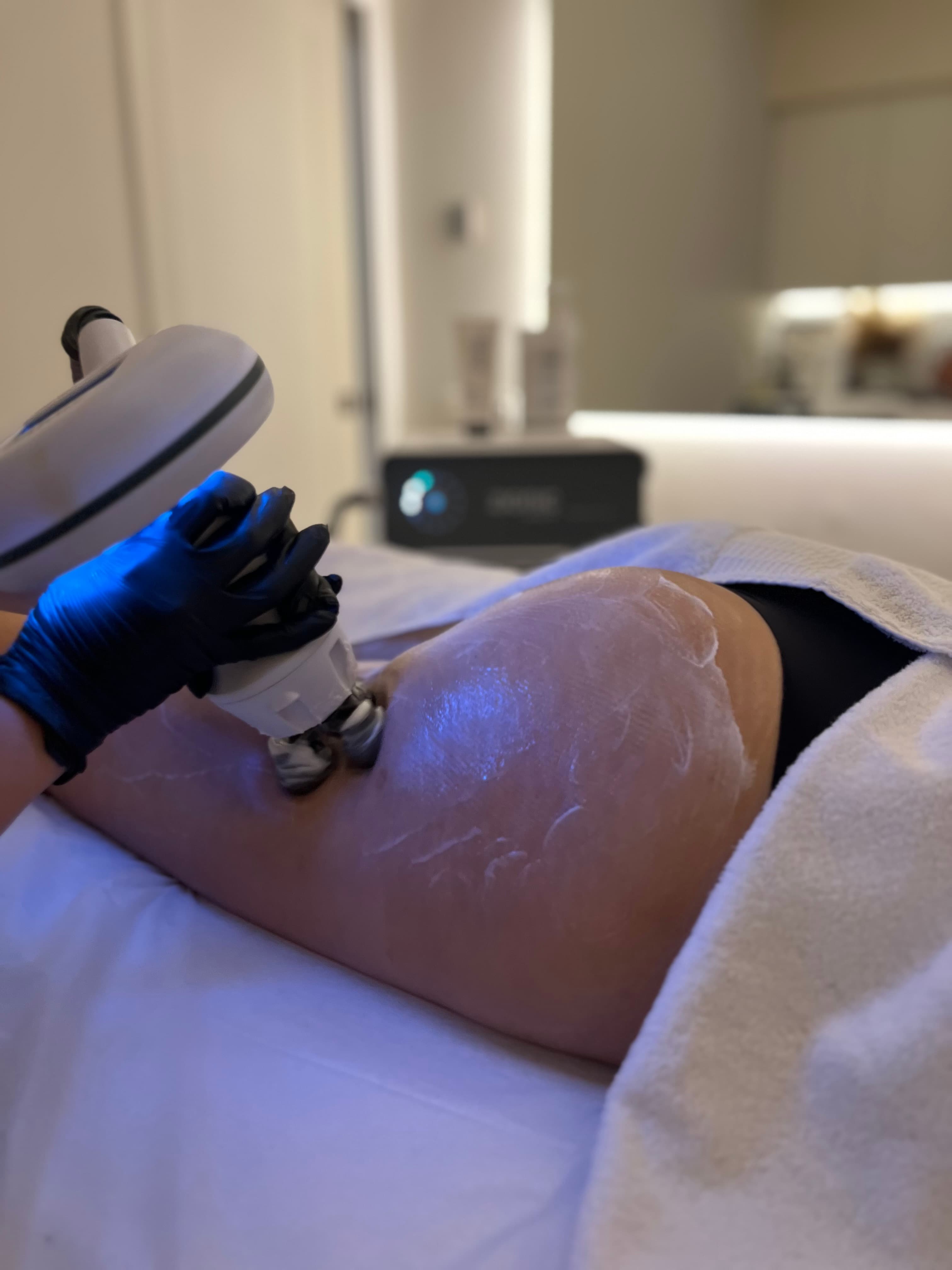 INDIBA Body Sculpting treatment at Bloom Beauty