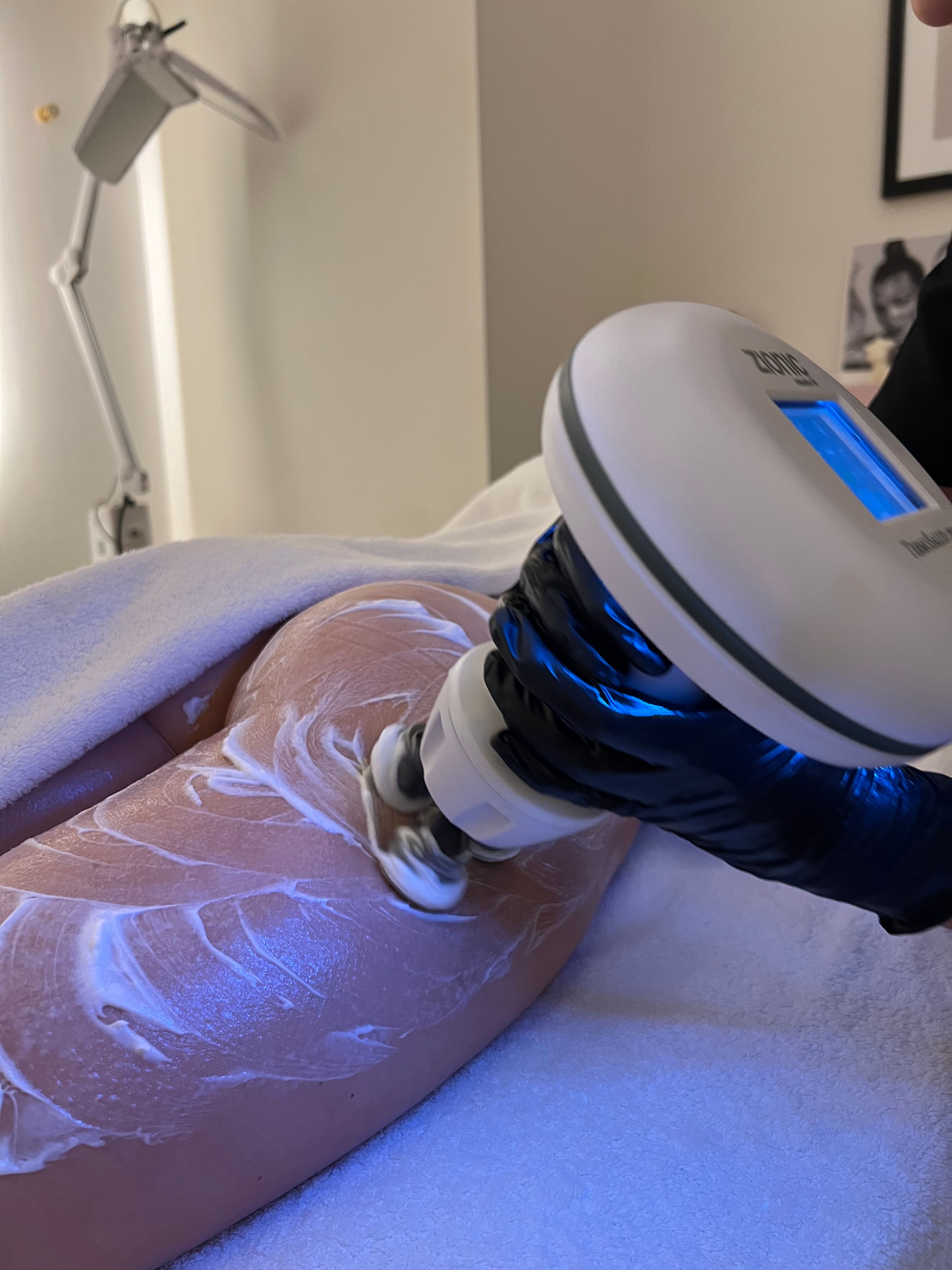 ZIONIC RF REMODELACIÓN Y REAFIRMACIÓN CORPORAL — tratamiento en Bloom Beauty