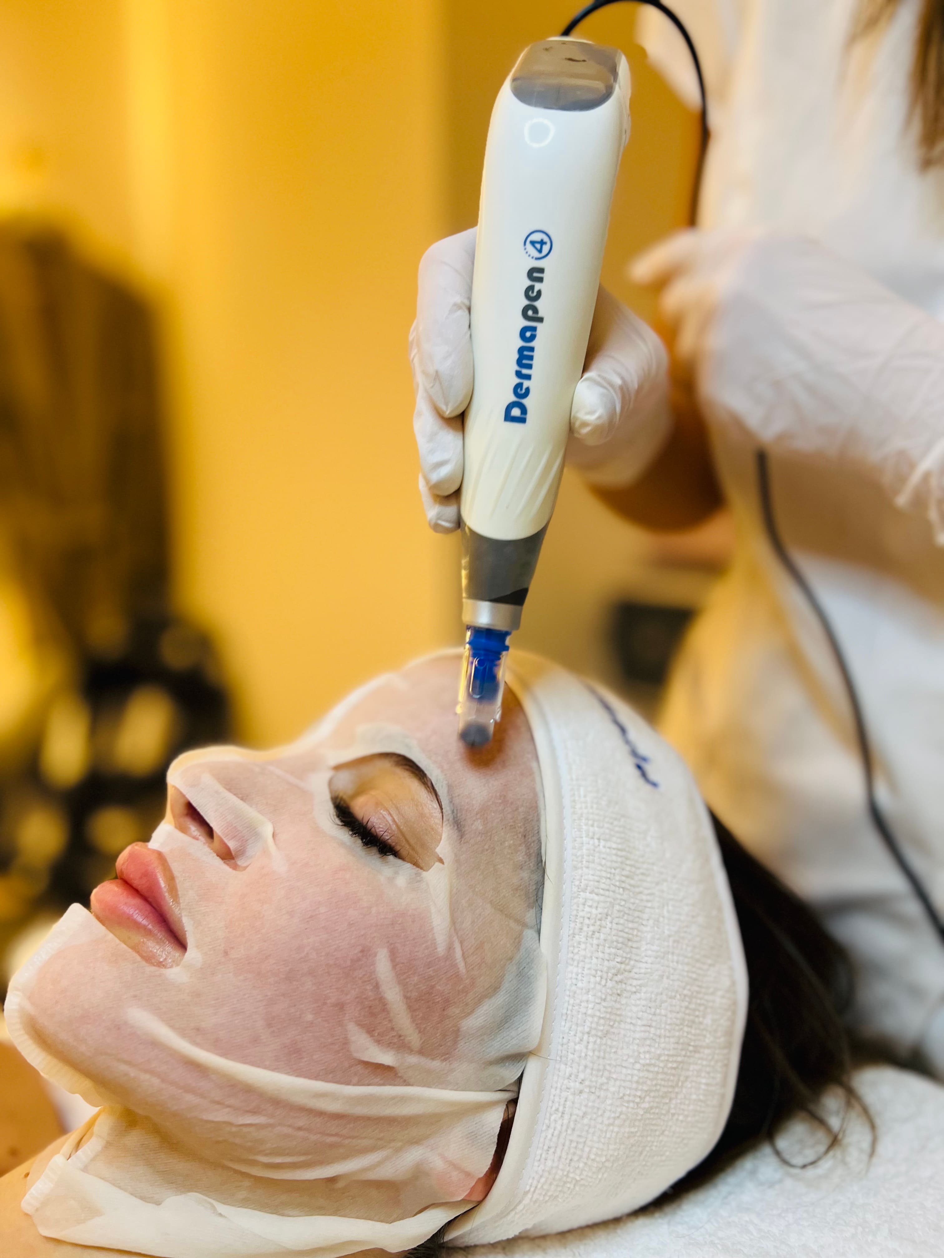 MICRONEEDLING CON DERMAPEN 4 — tratamiento en Bloom Beauty