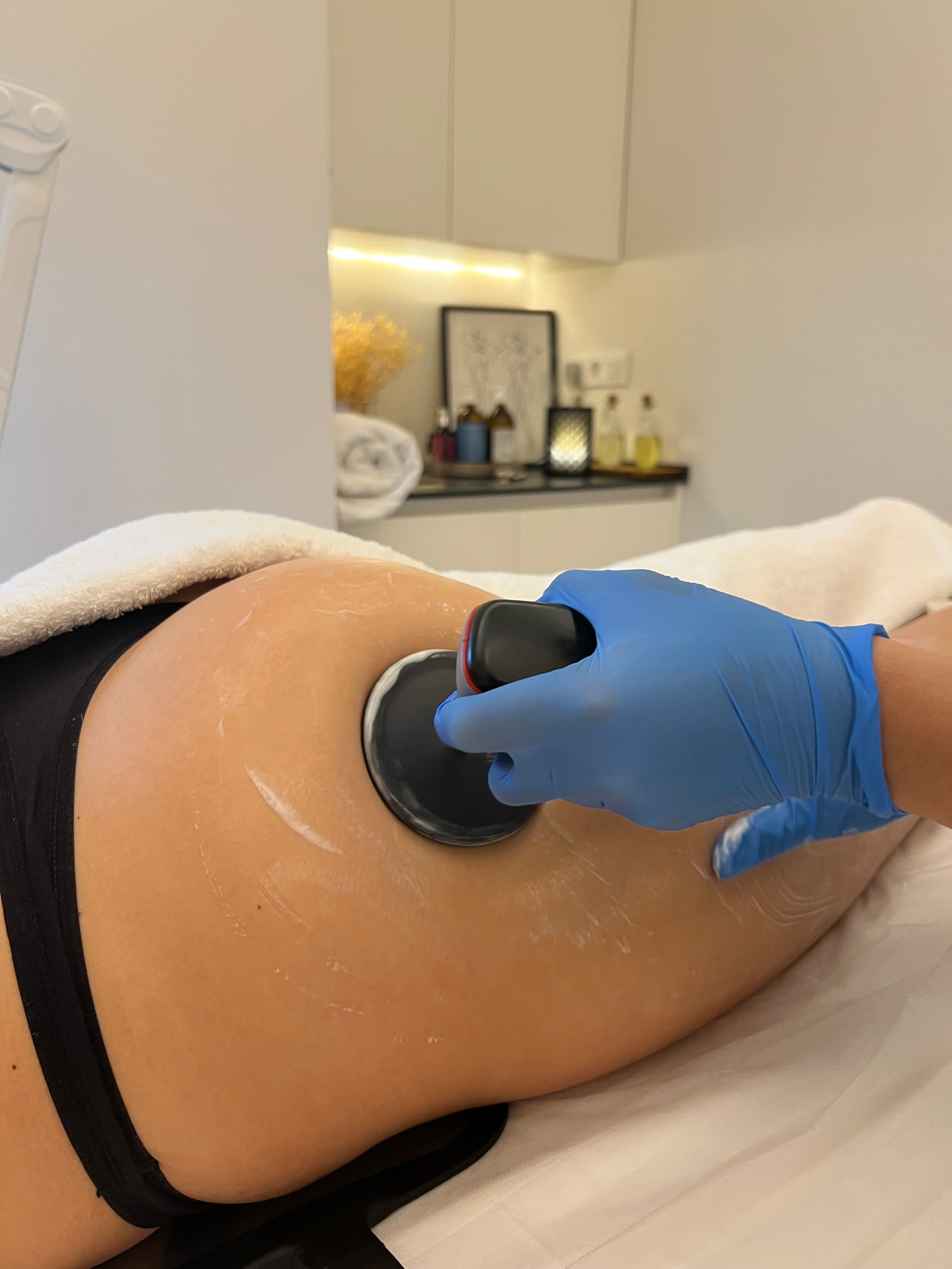 INDIBA body treatment at Bloom Beauty San Pedro